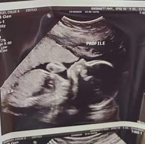 Meet your Posher, Chloe